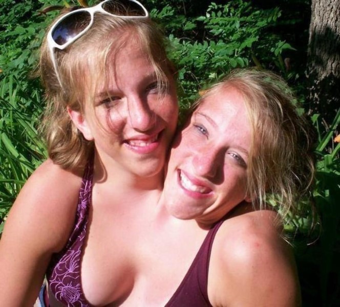 15 Unbelievable Facts About World Famous Conjoined Twins Abby And Brittany Hensel...